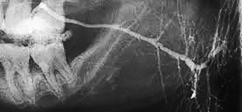 Медицина полости рта – мост между стоматологией и медициной