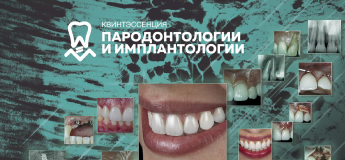 Международный симпозиум Квинтэссенции по пародонтологии и имплантологии
